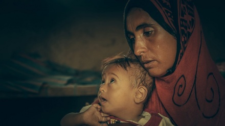 چالیس لاکھ یمنی بچے اور خواتین غذائی قلت کا شکار