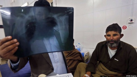 طالبان: جامعه جهانی برای از بین بردن بیماری سل همکاری کند