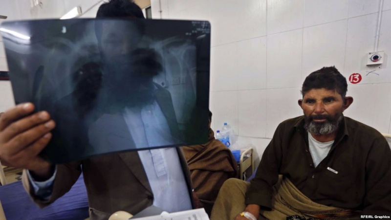 طالبان: جامعه جهانی برای از بین بردن بیماری سل همکاری کند