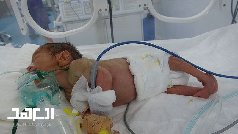 Rekordan broj malformacija novorođenčadi u Jemenu