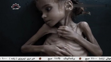 یونیسف : بیشتر از 11 هزار کودک طی جنگ یمن کشته و زخمی شده اند!