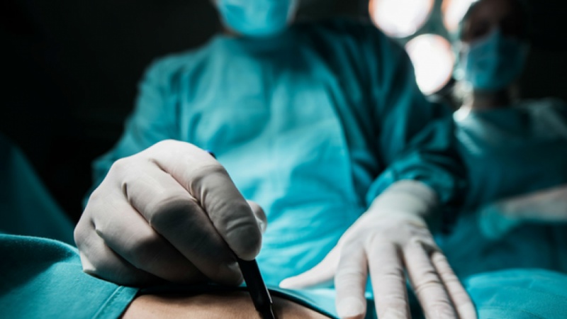 Zona më e rrezikshme për të kryer operacione plastike, paralajmërojnë kirurgët 