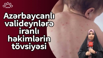  Azərbaycanlı valideynlərə iranlı həkimlərin tövsiyəsi
