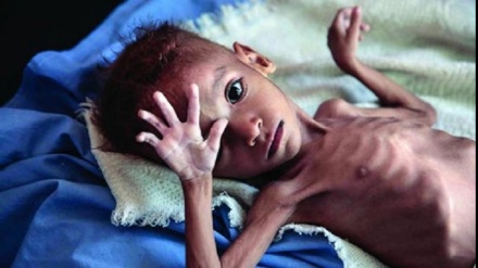 بەدخۆراکیی ئەو منداڵانەی لە شەڕی غەززەدا لەدایک دەبن
