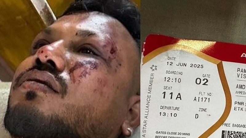 ہندوستان : طیارہ حادثہ میں ایک شخص زندہ بچا، بتائی حادثہ کے وقت کی صورت حال