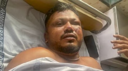 احمد آباد طیارہ حادثہ:  واحد زندہ بچ جانے والے مسافر وشواس کمار نے بتایا پورا واقعہ