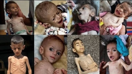 Rekora bêmînak a şehîdkirina gelê Xezzeyê ya bi birsîragirtinê