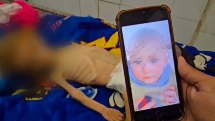 ŠEHADET 69 DJECE U GAZI ZBOG NEUHRANJENOSTI
