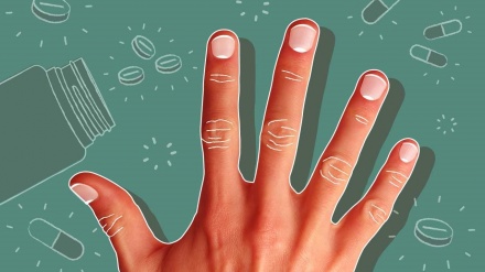 پارێزگاریکردن لە نینۆکی سرووشتی - بەشی 1