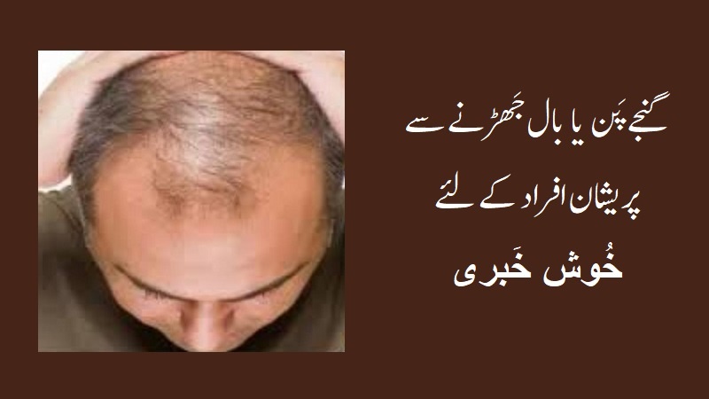 اب گنجے پن کا علاج ممکن، سائنسی تحقیق کے حیرت انگیز نتائج