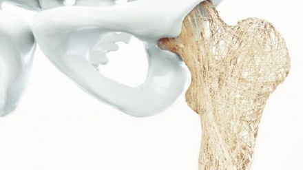 Bêdengiya hestiyan; çawa xilxilîna hestiyan bêdeng gefê li tenduristiyê dixwe?