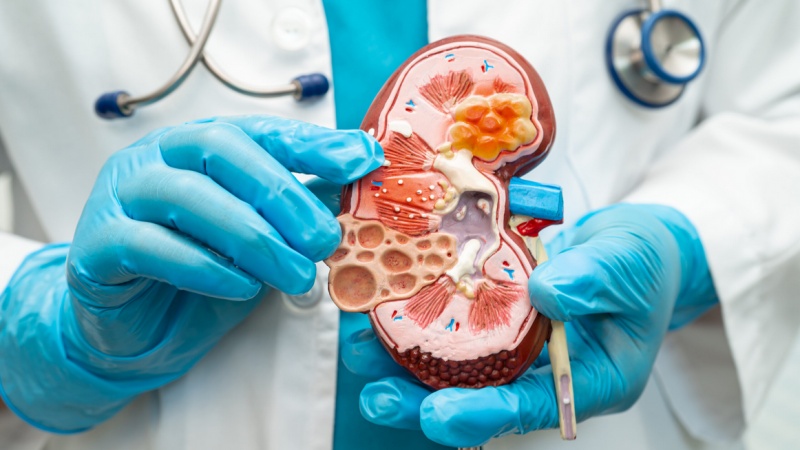 گردوں کے تکلیف دہ امراض سے تحفظ فراہم کرنے والی بہترین غذا